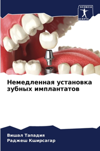 Немедленная установка зубных имплантато&