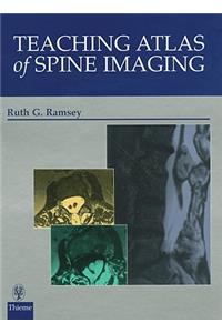 Teaching Atlas of Spine Imaging