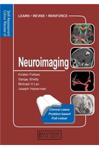 Neuroimaging