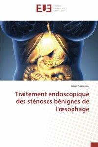 Traitement endoscopique des sténoses bénignes de l'oesophage