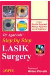 Dr Agarwal's Step by Step LASIK Surgery (With CD-ROM)