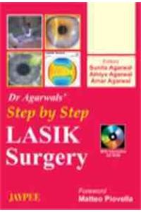 Step by Step Lasik Surgery