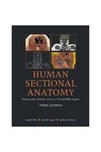 Human Sectional Anatomy Atlas of Body Sections, CT and MRI Images