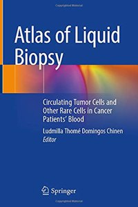 Atlas of Liquid Biopsy