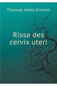 Risse des cervix uteri