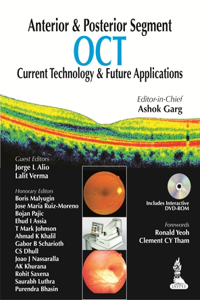 Anterior & Posterior Segment Oct: Current Technology & Future Applications