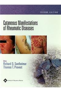 Cutaneous Manifestations of Rheumatic Diseases