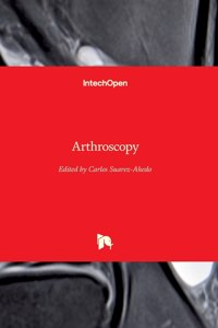 Arthroscopy