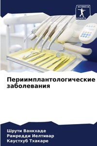 Периимплантологические заболевания