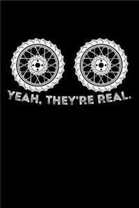 Yeah, They Are Real.