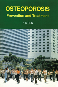 Osteoporosis – Prevention and Treatment