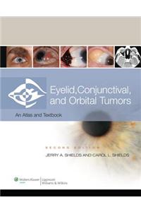 Eyelid, Conjunctival, and Orbital Tumors