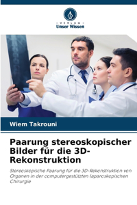 Paarung stereoskopischer Bilder für die 3D-Rekonstruktion