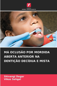 MÁ Oclusão Por Mordida Aberta Anterior Na Dentição Decídua E Mista