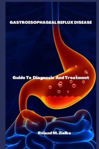 Gastroesophageal Reflux Disease