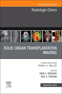 Solid Organ Transplantation Imaging, an Issue of Radiologic Clinics of North America, E-Book