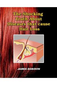 Shocking Truth About Diseases that Cause Hair Loss