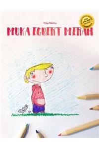 Muka Egbert Merah