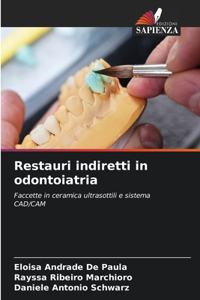 Restauri indiretti in odontoiatria