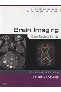 Brain Imaging: Case Review Series