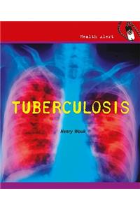 Tuberculosis