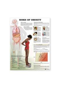 Risks of Obesity Anatomical Chart