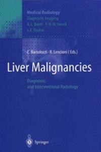 Liver Malignancies