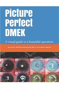 Picture Perfect Dmek