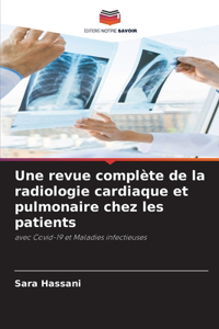 revue complète de la radiologie cardiaque et pulmonaire chez les patients