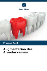 Augmentation des Alveolarkamms