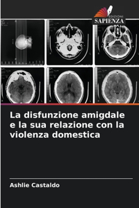 disfunzione amigdale e la sua relazione con la violenza domestica