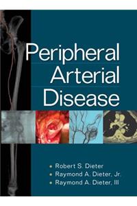 Peripheral Arterial Disease