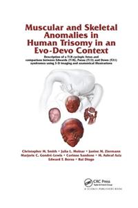 Muscular and Skeletal Anomalies in Human Trisomy in an Evo-Devo Context: Description of a T18 Cyclopic Fetus and Comparison Between Edwards (T18), Patau (T13) and Down (T21) Syndromes Using 3-D Imaging and Anatomical Illu