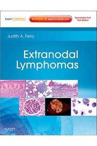 Extranodal Lymphomas