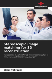 Stereoscopic image matching for 3D reconstruction