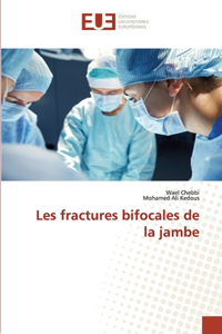 Les fractures bifocales de la jambe