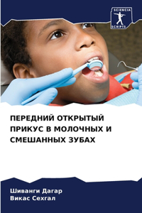 ПЕРЕДНИЙ ОТКРЫТЫЙ ПРИКУС В МОЛОЧНЫХ И СМЕj