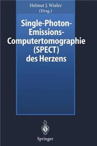 Single-Photon-Emissions-Computertomographie (Spect) Des Herzens