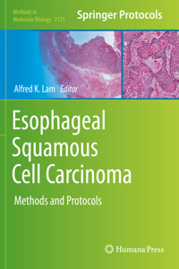 Esophageal Squamous Cell Carcinoma