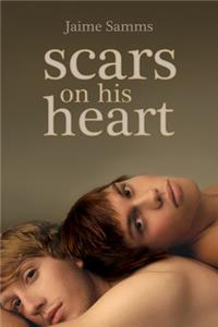 Scars on His Heart