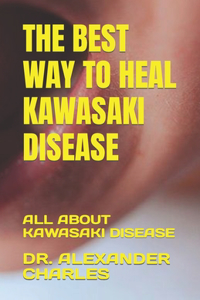 Best Way to Heal Kawasaki Disease