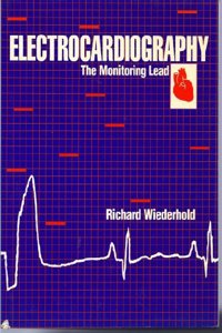 Electrocardiography: Monitor Lead