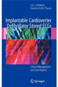 Implantable Cardioverter Defibrillator Stored ECGs