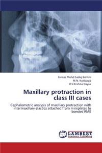 Maxillary Protraction in Class III Cases