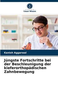 Jüngste Fortschritte bei der Beschleunigung der kieferorthopädischen Zahnbewegung