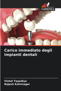 Carico immediato degli impianti dentali