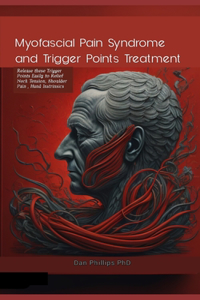 Myofascial Pain Syndrome and Trigger Points Treatment