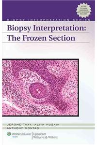 Biopsy Interpretation: The Frozen Section