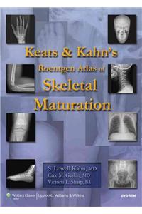 Keats and Kahn's Roentgen Atlas of Skeletal Maturation
