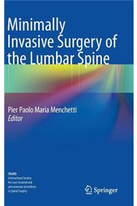 Minimally Invasive Surgery of the Lumbar Spine